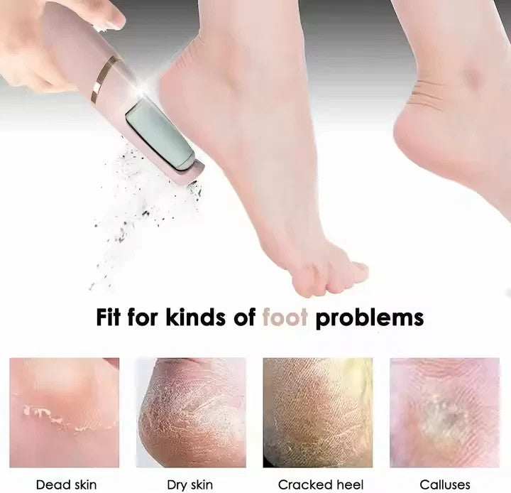 Electric foot file callus remover, USB rechargeable hard skin remover – photo 9